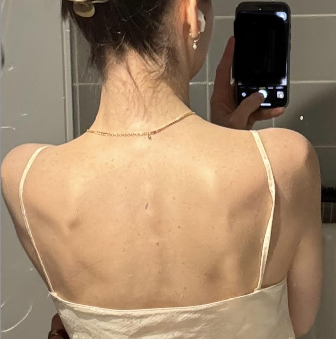 files/back_after.jpg
