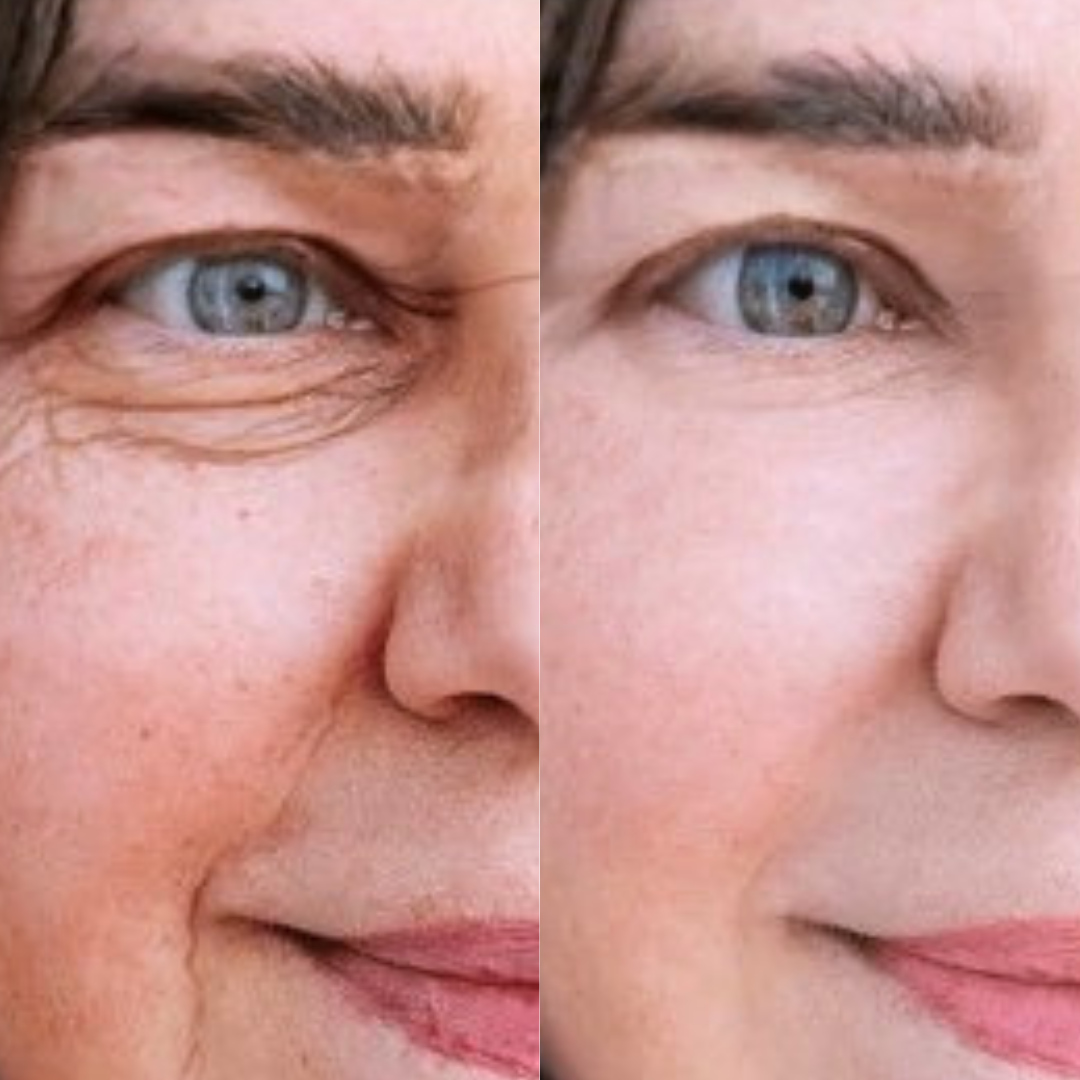 files/shutterstock_women_before_afte_9e702c9f-0b34-4a59-ad01-3c99c465901f.png